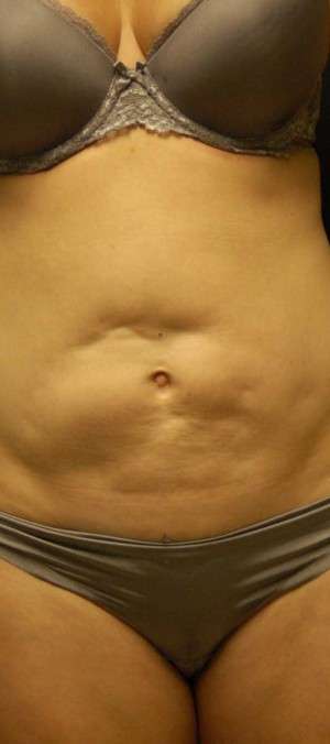 Reparative/Corrective Body Surgery