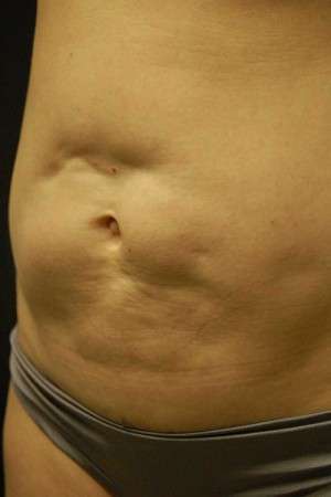 Reparative/Corrective Body Surgery