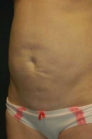 Reparative/Corrective Body Surgery