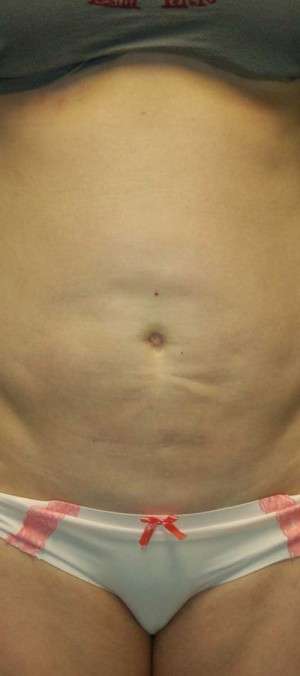 Reparative/Corrective Body Surgery