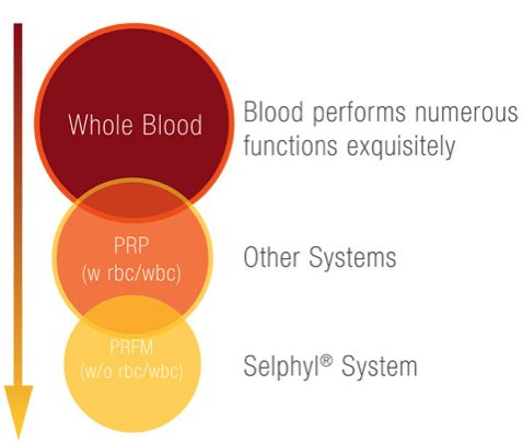 PRFM Diagram