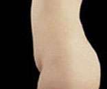 Abdominoplasty