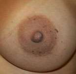 Breast Round, Saline