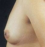 Breast Round, Saline