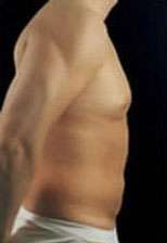 Liposculpture (Male)