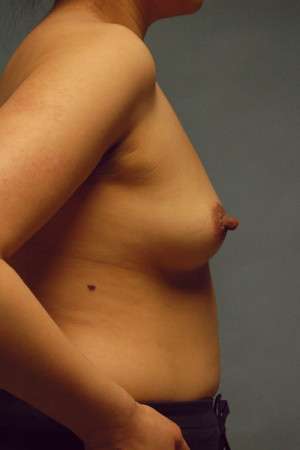 Ideal Structured Saline