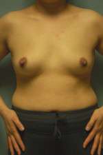 Ideal Structured Saline
