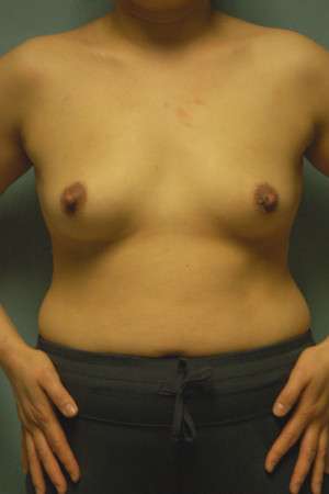 Ideal Structured Saline