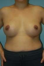 Ideal Structured Saline