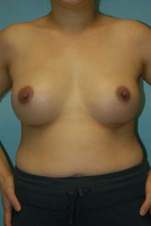 Ideal Structured Saline