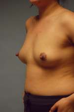 Ideal Structured Saline