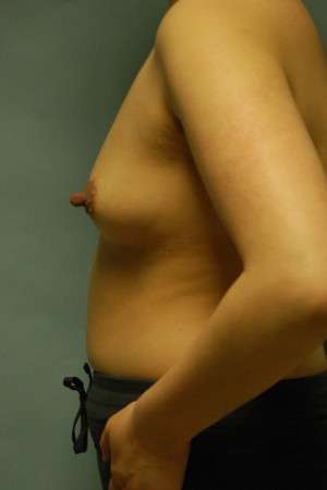 Ideal Structured Saline