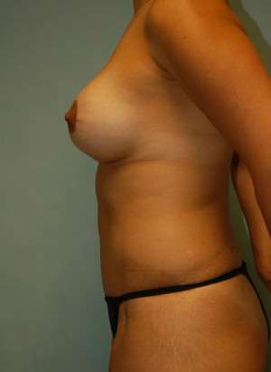 Ideal Structured Saline