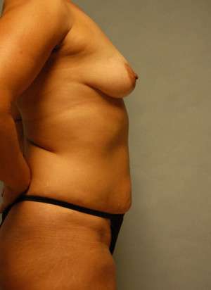 Ideal Structured Saline