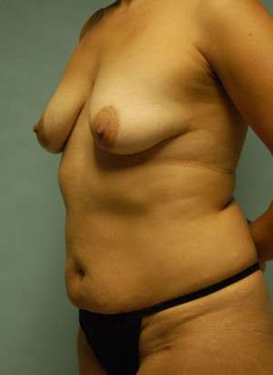 Ideal Structured Saline