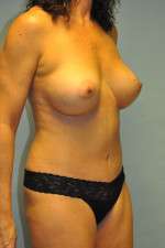 Ideal Structured Saline