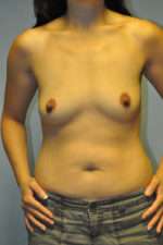 Ideal Structured Saline