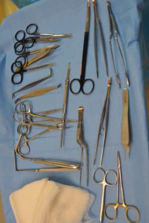 Minimal Incision and Power-assisted Liposuction Removal of Lipomas