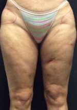 Reparative/Corrective Body Surgery