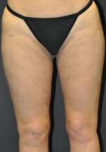 Reparative/Corrective Body Surgery