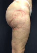 Reparative/Corrective Body Surgery