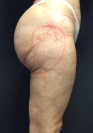 Reparative/Corrective Body Surgery