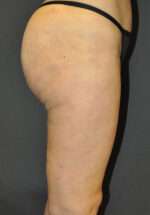 Reparative/Corrective Body Surgery