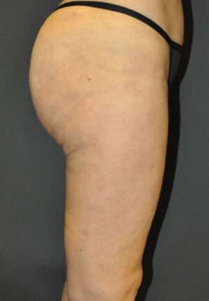 Reparative/Corrective Body Surgery