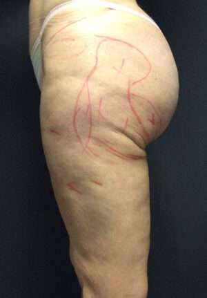 Reparative/Corrective Body Surgery