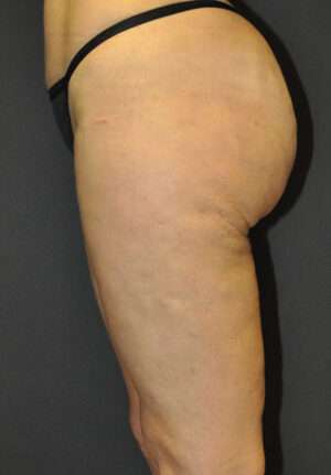 Reparative/Corrective Body Surgery