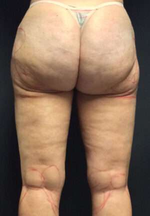 Reparative/Corrective Body Surgery