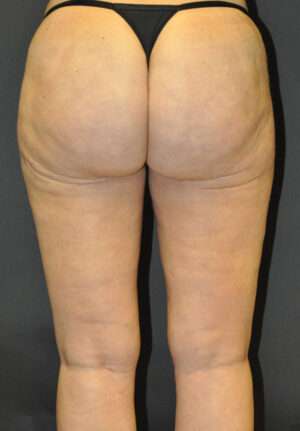 Reparative/Corrective Body Surgery