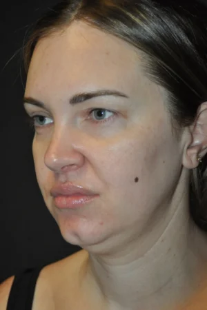MyEllevate