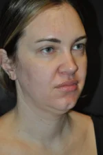 MyEllevate
