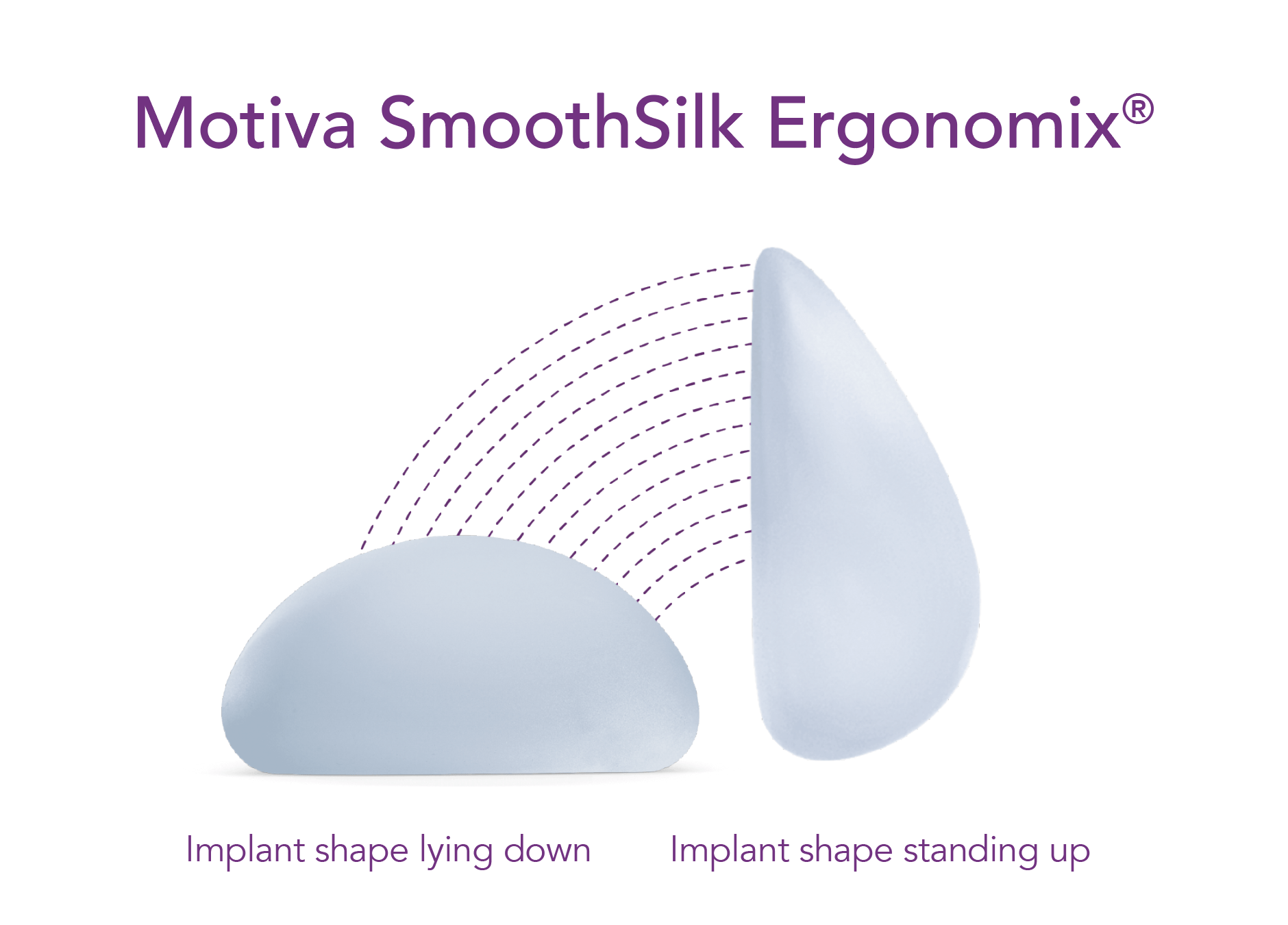 motiva breast implant diagram